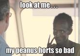 look at me... my peanus horts so bad