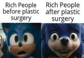 Rich People before plastic surgery Rich People after plastic surgery