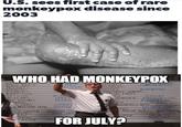 U.S. sees first case of rare monkeypox disease since 2003 WHO HAD MONKEYPOX WE VES COMMUNICATIONS ALIEN BEAST MUTANTS WRAITHS MED MOLITION NOWMAN AGON BAT AMPIRES DISTRIBUT KAT ZOMBIES EMEERMENT GOBLINS REPTILIUS FLUM FAIRY CLOWNS BLESS AN HADLEY WITCHES OPERA NIMATED ADMINISTRATION KY WITCHES ARCHIVI ENGINEERING MON'S ON L. LORD SITTERS ENDIGO YETI MOLESTING TREE WRANGI KITCHEN STAFF DPS ACCOUNTING TORTURE FAMILYHANIE NARZE T SNAKE INTERNAL LO PITES STORY DEP RENALD IN INTERN YIN NTERN SECURITY MMY ZOOLOGY BRIDE Den FOR JULY?