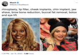 Meech @MediumSizeMeech rhinoplasty, lip filler, cheek implants, chin implant, jaw shave, brow bone reduction, buccal fat removal, botox and eye lift 1:34 PM Jan 15, 2023 7.2M Views F--