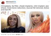 Bilal Hassani @iambilalhassani : rhinoplasty, lip filler, cheek implants, chin implant, jaw shave, brow bone reduction, buccal fat removal, botox and eye lift JIET DECORD 12:01 PM Jan 15, 2023 917.2K Views