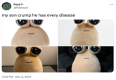 Foca @fiddlepie my son crump he has every disease 4:34 PM Dec 3, 2021 ...