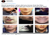 PLEASE SUMMO SOMEONE ELSE SalomeAF @salome_af Replying to @benshapiro Good question: when did you know that lip filler migrates? And what did you think it would look like? 4:57 PM. Feb 3, 2023 449 Views :