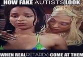 HOW FAKE AUTISTS LOOK WHEN REALRETARDS COME AT THEM