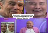 USIVO I @Bucetossauro_ Gostaram do resultado da harmonização facial do Stênio Garcia? I SESSÃO HARMONIZAÇÃO FACIA #FofocalizandoNoSBT Diario de um Noveleiro