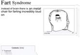 Fart Syndrome instead of brain there is an metal chair for farting incredibly loud on 1 Treatment FIMMHITWITH TEMMHEITWER Contents [hide] Like this In