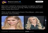 PRESS Royce Lopez @hippojuicefilm Women need to stop plastic surgery until we figure out what's wrong. Why would you ruin your face like this? B This is Erin Moriarty from The Boys...she was already very pretty. 6:26 PM 1/14/24 From Earth 28M Views Follow ● ●