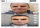 ☆ @getlikedevyn he needs to sue that plastic surgeon omfg LIVE Following Friends For You Dr.Kim 51 years old Follow Dr. KIM A client from Spain and had a full facelift. He looks 1... more 11:57 AM Jan 18, 2024 10.7M Views + TikTok: D6.6Kin 1,361 1,205 1,111