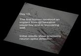 Day 13, The first human received an implant from @Neuralink yesterday and is recovering well. Initial results show promising neuron spike detection.