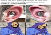 Some are now getting the inside of their ears removed in a new body modification trend called a "conch removal." A SIGH (7IP