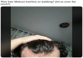 Thin hair Mature hairline or balding? (Ist es over für mich?)