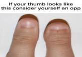 If your thumb looks like this consider yourself an opp