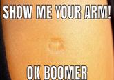 A photo of a TB vaccine scar. The caption reads, "Show me your arm! OK boomer."