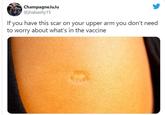 A screenshot of a now-deleted tweet by @jhabashy15. The post reads, "if you have this scar on your upper arm you don't need to worry about what's in the vaccine." Below is a photo of someone's TB vaccine scar.
