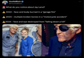 HustleBitch @HustleBitch_ What do you notice about Jay Leno? A 2022 - face and body burned in a "garage fire" A 2023 - multiple broken bones in a "motorcycle accident" A 2024 - face and eye destroyed from "falling down a hill" EN