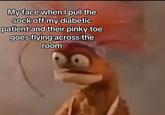 My face when I pull the sock off my diabetic patient and their pinky toe goes flying across the room