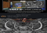 A meme asking if the giant corpse beneath "Apple's":https://knowyourmeme.com/memes/subcultures/apple headquarters can run "_Doom_":https://knowyourmeme.com/memes/subcultures/doom or not.