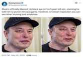 X user @YourAnonCentral tweeted a photo of Elon Musk sporting a black eye during a late May Oval Office appearance, alleging that Musk was harboring a number of other injuries. The post read, "Musk's officially blamed his black eye on his 5 year old son, claiming he told him to punch him as a game. However, on closer inspection you can see other bruising and scratches."