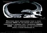 EMPOWERING FACT BLOOD RAVEL CHEE AQUISITION AL PIULIC DOCTORS ONCE DISCOVERED THAT A MAN MISSING 90% OF HIS BRAIN WAS LIVING A COMPLETELY NORMAL LIFE-WORKING, PLAYING ELDAR, AND UNAWARE OF THE CONDITION UNTIL A SCAN REVEALED IT. g.comEMPOWERING FACTS imgflip.com FACTSG