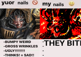yuor nails ① my nails -BUMPY WEIRD -GROSS WRINKLES -UGLY!!!!!!!! -THINKS! = SAD!! THEY BITI