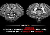 SCEX missing Science shows D&D games literally causes your brain to shrink