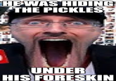 HE WAS HIDING THE PICKLES UNDER HIS FORESKIN