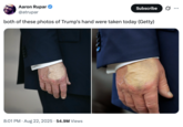 A "tweet":https://knowyourmeme.com/memes/sites/twitter-x with both August 2025 photos of "U.S.":https://knowyourmeme.com/memes/cultures/united-states-of-america President "Donald Trump's":https://knowyourmeme.com/memes/people/donald-trump hand with what appears to be a layer of makeup foundation covering an injury.