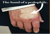 A "quote-tweet":https://knowyourmeme.com/memes/quote-retweets-qrts joking about "Donald Trump":https://knowyourmeme.com/memes/people/donald-trump and the makeup/bruising on his hand, which caused speculation about his impending death.