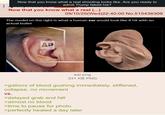 : Now that you know what a real shooting looks like. Are you ready to admit Trump faked his? Now that you know what a real (...) 09/10/25(Wed)22:40:00 No.515436309 The model on the right is what a human ear would look like if hit with an actual bullet AP ear.png 331 KB PNG >gallons of blood gushing immediately, stiffened, collapse, no movement VS. >delayed grab and fall >almost no blood >time to pause for photo >perfectly healed a day later