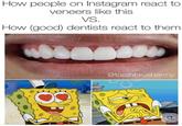 How people on Instagram react to veneers like this VS. How (good) dentists react to them @toothbrusharmy 8 www