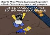 Major C. M De Villiers diagnosing the problem. in Mario Olivera's x-ray scans during surgery: HE'S A BOMB! MY BOY'S A BOMB! DAMN YOU! A BOMB!