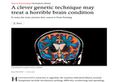 Science & technology | Huntington's disease A clever genetic technique may treat a horrible brain condition It stops the toxic protein that causes it from forming Share PHOTOGRAPH: SCIENCE PHOTO LIBRARY Sep 24th 2025 | 3 min read UNTINGTON'S DISEASE is arguably the nastiest inherited illness around. Symptoms include involuntary jerking, difficulty swallowing and speaking,