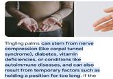 Tingling palms can stem from nerve compression (like carpal tunnel syndrome), diabetes, vitamin deficiencies, or conditions like autoimmune diseases, and can also result from temporary factors such as holding a position for too long. If the