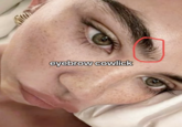 eyebrow cowlick