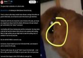 A post theorizing that Hasan used a shock collar on his dog. The post points out the green blip on the collar.