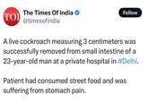 The Times Of India TOI @timesofindia Follow A live cockroach measuring 3 centimeters was successfully removed from small intestine of a 23-year-old man at a private hospital in #Delhi. Patient had consumed street food and was suffering from stomach pain.