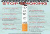 YOUR BODY AFTER YOU STOPSMOKING ! AFTER 20 MINUTES: Blood pressure goes down. •Heart rate goes down. Hands and feet get warmer. AFTER 8 HOURS: ! • Blood carbon monoxide levels return to normal. •Blood oxygen levels go up. !AFTER 24 HOURS: Heart attack risk is lower. !AFTER 72 HOURS: Bronchial tubes start to relax. •Easier to breathe. ! AFTER 1 YEAR: •Heart disease risk is cut in half. D 32 AFTER 48 HOURS: ! • Body becomes free of nicotine. •Nerve endings adjust to missing nicotine. •Sense of taste and smell start to improve. AFTER 2-13 WEEKS:! • Blood circulates better. • Exercise is easier. ! AFTER 10 YEARS: •Lung cancer risk is cut in half. AFTER 5 YEARS: ! • Cervical cancer risk same as nonsmoker. Stroke risk same as nonsmoker. •Cancer risk of the mouth, throat, esophagus, and bladder is cut in half. Sources: American Cancer Society.CDC. Indian Journal of Psychiatry. Smokefree NHS.
