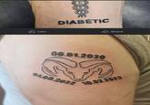Like DIABETIC 06.01.2020 04.08.2022 Share 10.02.2023