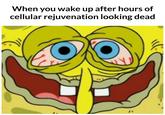 When you wake up after hours of cellular rejuvenation looking dead