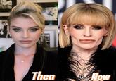 Then Now