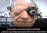 O Australian Scientists Have Created a Bionic Eye that Connects Directly to the Brain