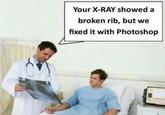 Your X-RAY showed a broken rib, but we fixed it with Photoshop