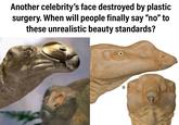 Another celebrity's face destroyed by plastic surgery. When will people finally say "no" to these unrealistic beauty standards? B