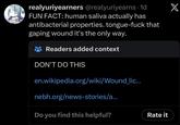 weah ok bro You were REAL VU realyuriyearners @realyuriyearns ⚫1d FUN FACT: human saliva actually has antibacterial properties. tongue-f--- that gaping wound it's the only way. Readers added context DON'T DO THIS en.wikipedia.org/wiki/Wound_lic... nebh.org/news-stories/a... Do you find this helpful? Rate it X