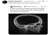 Orikan the divi... @bread_nou.... 14h H-------- they scanned a space wolf • Anonym... @YourAnon... Apr 15 A man was discovered with almost 90% of his brain mass missing, while leading an almost normal life.