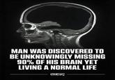 MAN WAS DISCOVERED TO BE UNKNOWINGLY MISSING 90% OF HIS BRAIN YET LIVING A NORMAL LIFE SOCIATY