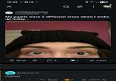 19:49 M. ☑ ib 55 r/mildlyinteresting u/cloudblythe ⚫ 8h My pupils were 2 different sizes when I woke up today... 28.3k 3... 7 6,859 Narthesia 8h Hopital ÷ Reply 8 12878