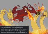 Yes. Severe burns from fire damage or cauterization can destroy the critical tissues and nerve endings required to regenerate a limb, and the intense trauma is often fatal.