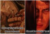 I lost my finger! In that damn volcano! Oh no! Boo f-----' hoo!