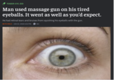 TENDER-EYE-ZED Man used massage gun on his tired eyeballs. It went as well as you'd expect. He had retinal tears and bruises from squishing his eyeballs with the gun. BETH MOLE - JUN 22, 2026 6:02 PM 165